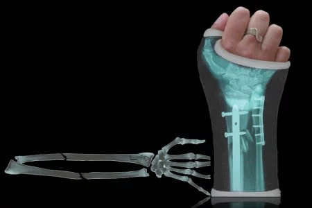 L’assurance perte de licence