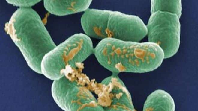 Air France et listéria